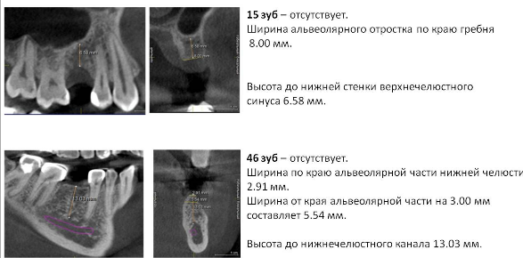 opisanie_zybov